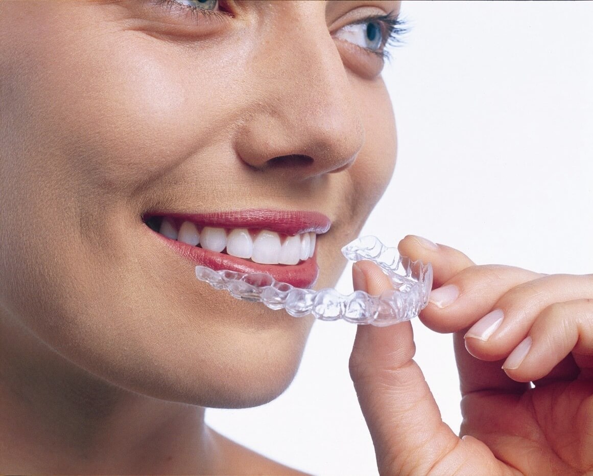 A woman holding her Invisalign retainers up